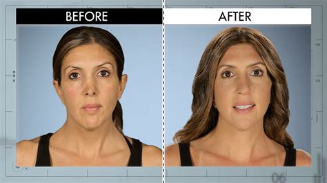 Botched Plastic Surgery Before And After Tv Show