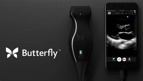 FDA clears Butterfly Network's iQ 'ultrasound-on-a-chip' – MassDevice