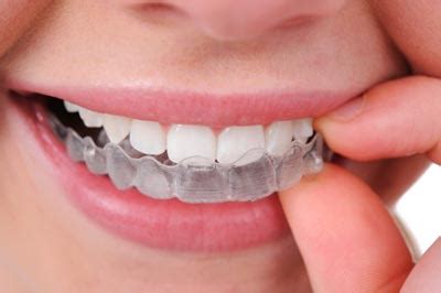 Clear Aligners For Teeth: Invisible Braces Cost, Treatment In India