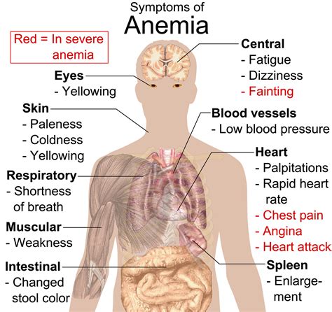 Sickle Cell Symptom #1- Anemia - 10003 WARRIOR PROJECT