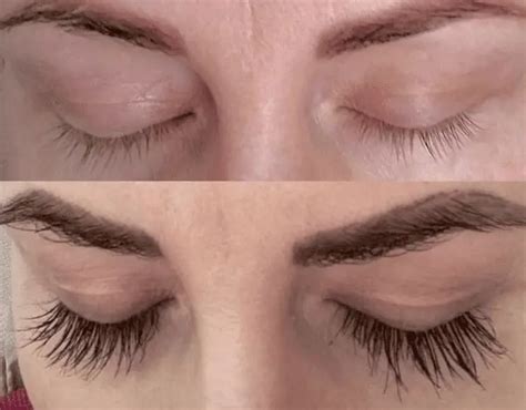 Want an Eyelash Growth Serum That Works? 7 Key Things to Look For