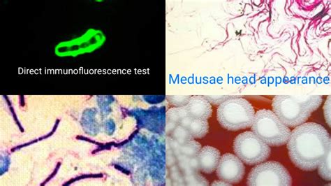 Bacillus anthracis ( Lab diagnosis , Treatment ) - YouTube