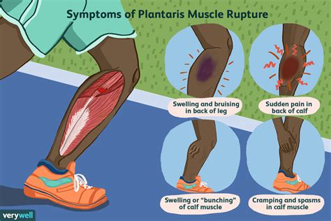 sore calf muscles - Grow Utility