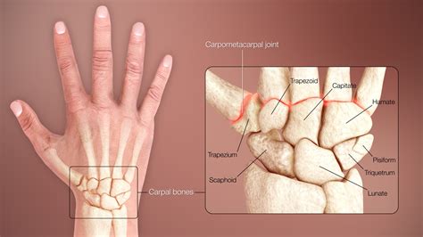 Wrist Injuries Treatment | Louisville & Lexington | Aptiva Health