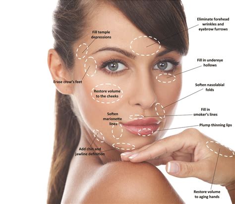 Beginner's Guide to Dermal Fillers. What to Expect? - Medwell Aesthetics