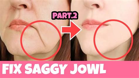 Anti-Aging Face Lifting Exercises For Sagging Jowls Part2