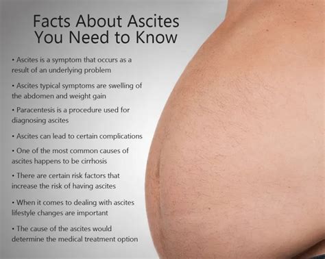 Ascites Facts and Medical Terms - Fatty Liver Disease