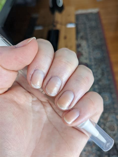 Super dry flaking nails....help? More info in comments. : RedditLaqueristas