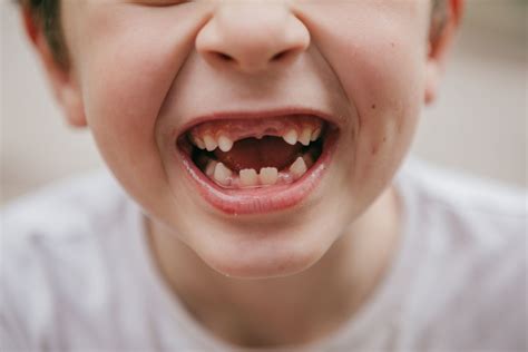 When do kids start losing teeth? Expert guide to baby teeth