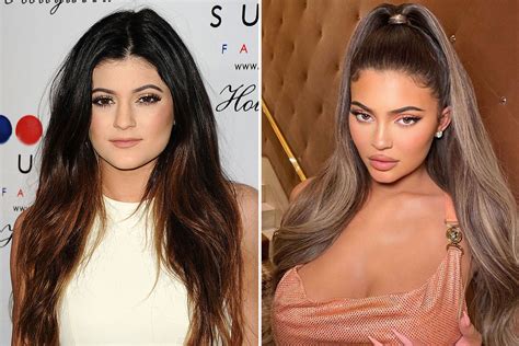 What did Kylie Jenner look like before and after lip filler? | The US Sun