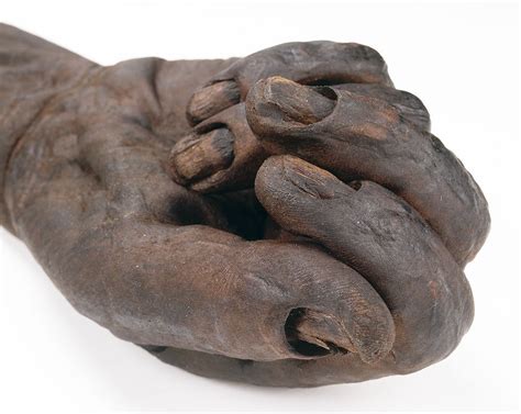 Dr Lindsey Fitzharris on Twitter: "The hand of Old Croghan Man, a 2000 ...