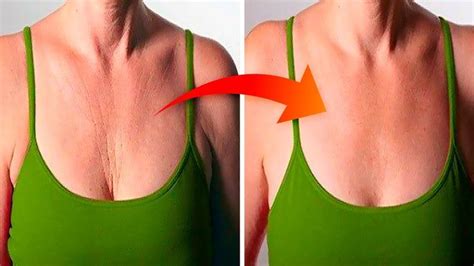 How to Reduce Neck and Chest Wrinkles at Home | Chest wrinkles, Reduce ...