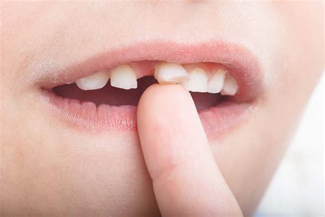 Should you Pull your Child’s Loose Baby Tooth? | Luna Pediatric Dentistry