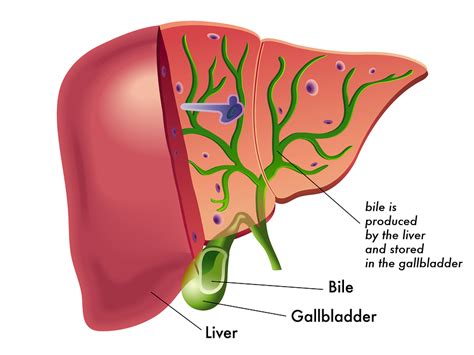 Bile and Motor Oil: Conservative Management of Small Gallbladder Stones ...