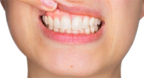 Top-rated Periodontal Treatments / Dentist in Los Angeles