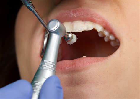 Teeth Cleaning Near Me | Sydney CBD Dentistry