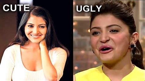 Anushka Sharma Plastic Surgery Before And After - sekho.in