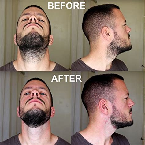 Aberlite FlexShaper - Beard Shaper Neckline Guide - Hands-Free ...