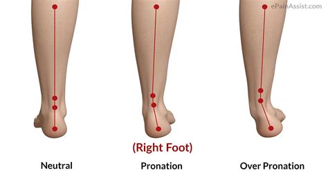 The Pronation Of Foot