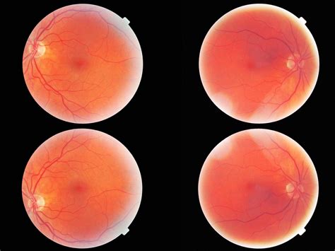 How an OCT scan could save your vision - Harries Opticians