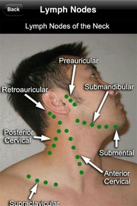 #MedicalVocabulary #VisualVocabulary Lymph node location and names for ...