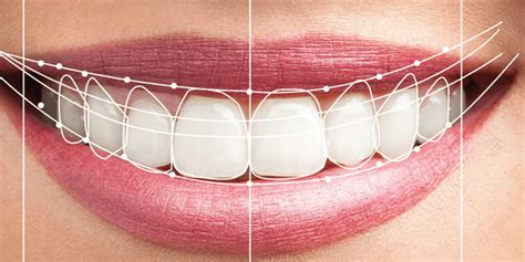 Best Smile Design - Asli Tarcan Dental Clinic Turkey