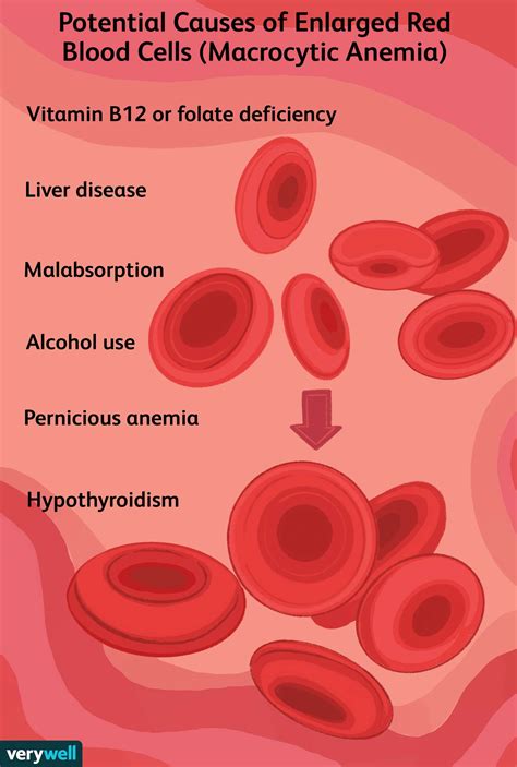 Megaloblastic Anemia Peripheral Smear