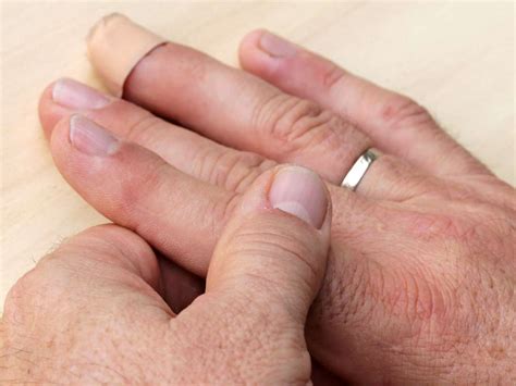 Finger pain: Causes, treatment, and self-care