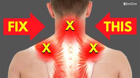 How to Fix a Sore Neck and Shoulders in SECONDS - YouTube