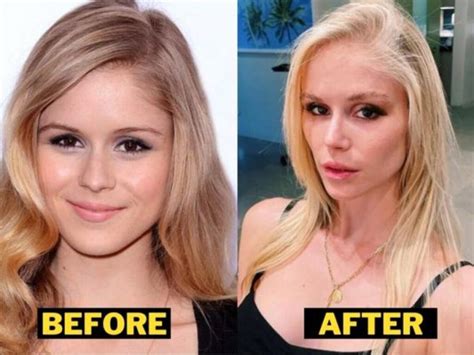 Erin Moriarty Before And After Pictures: Did Erin Moriarty Has ...