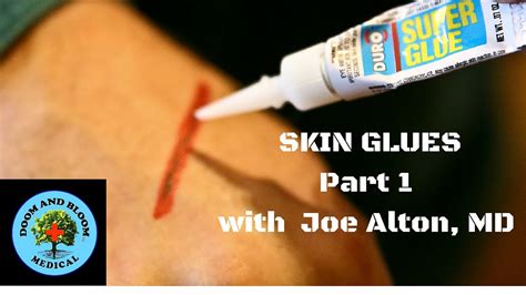 Skin Glues for Wound Closure Part 1 - YouTube