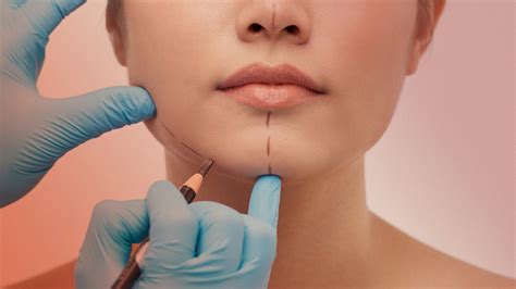 Experts Predict the Biggest Plastic Surgery Trends for 2023 | Allure