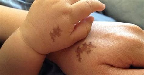 Birthmarks in Islam: Meaning and Significance | Religions Facts