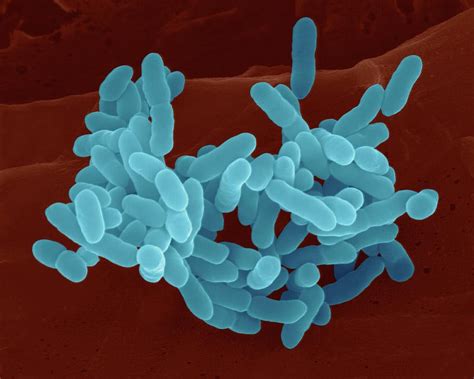 Proteus mirabilis uti antibiotic