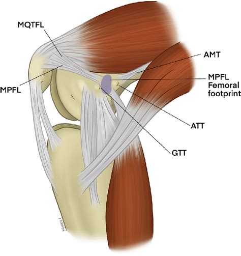 Medial Patellofemoral Ligament Injury Recovery: Capital Area PT