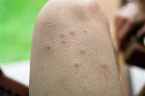 Midges in Scotland - What You Need to Know