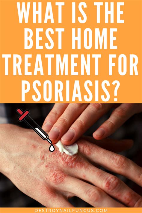 5 Amazing Home Remedies for Psoriasis That You Need To Try Now!