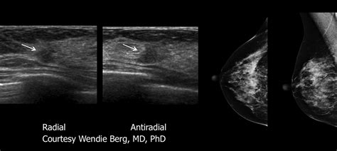 Department of Radiology | University of Pittsburgh