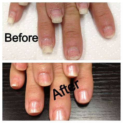 Thelma Baldwin Viral: Do Acrylic Nails Damage Natural Nails