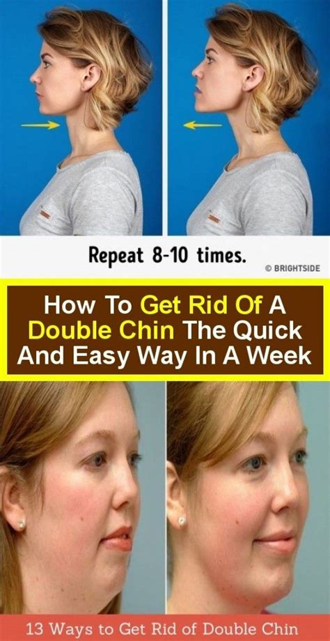 Awasome How To Get Rid Of Double Chin Surgery 2022