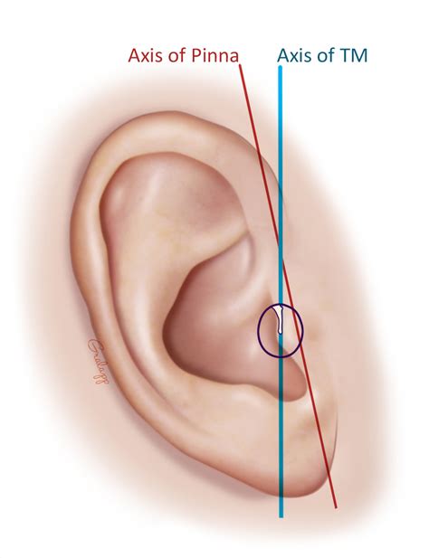 External Ear – Oto Surgery Atlas