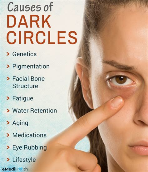 What Causes Dark Under Eyes - Infoupdate.org