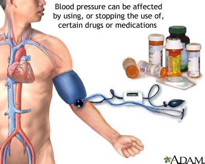 High blood pressure - medicine-related: MedlinePlus Medical Encyclopedia