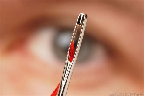 In the metaphor in Matt. 19:24, does the "eye of a needle" refer to a ...