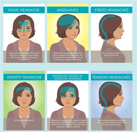 Headache Pain Diagram