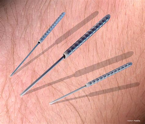 Acupuncture needles - Stock Image - M745/0177 - Science Photo Library