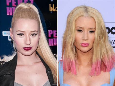 Iggy Azalea Before and After Pictures Hint She Has Undergone More ...