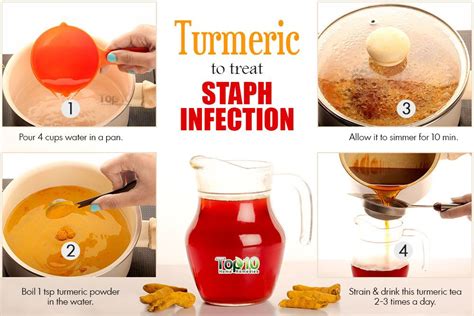 Home Remedies for Staph Infection | Top 10 Home Remedies