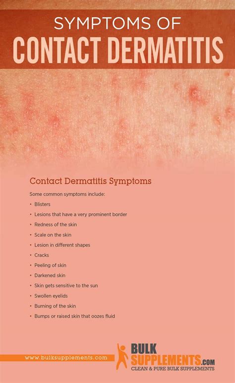 Tablo | Read 'Contact Dermatitis: Symptoms, Causes & Treatment' by