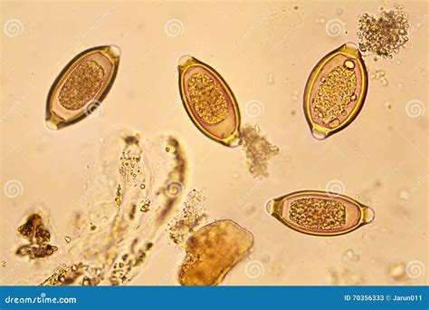 Trichuris Trichiura Under The Microscope. Royalty-Free Stock Image ...